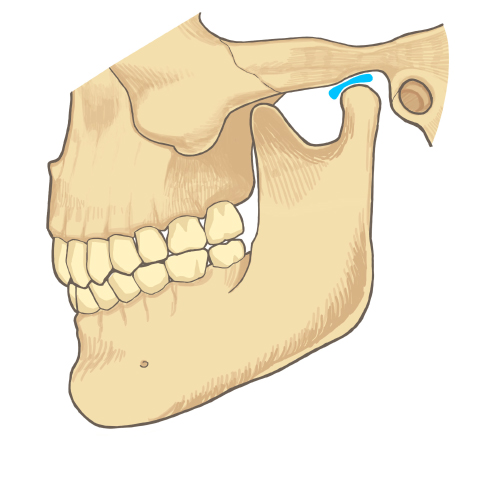 顎関節症の症状と要因